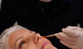 zabiegi dermapen